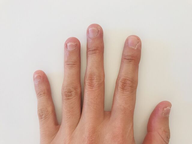 「男の爪が脳裏にこびりついて離れない」同窓会での怖い体験