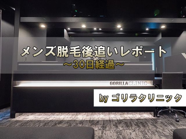 ヒゲ脱毛から１ヶ月が経過。あれっ毛が生えてくるのが遅れてきたぞ？
