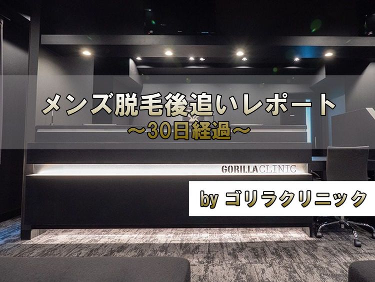 ヒゲ脱毛から１ヶ月が経過。あれっ毛が生えてくるのが遅れてきたぞ？